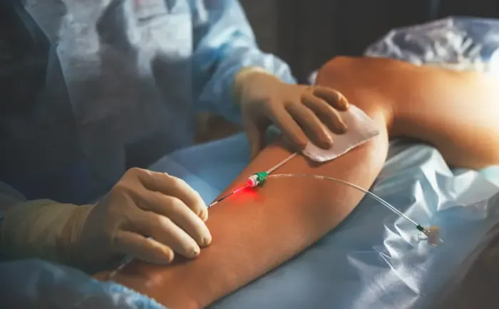 Vascular Surgery Guide Procedures, and Recovery